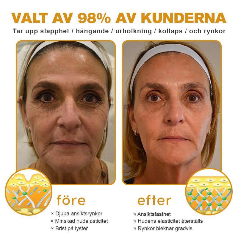 💎✨Tillverkad och skickad från Sverige✅Furzero™ Botox Bee Venom Wrinkle Removal Cream - Sista Dagen-kampanj 70 % RABATT