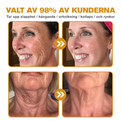 💎✨Tillverkad och skickad från Sverige✅Furzero™ Botox Bee Venom Wrinkle Removal Cream - Sista Dagen-kampanj 70 % RABATT