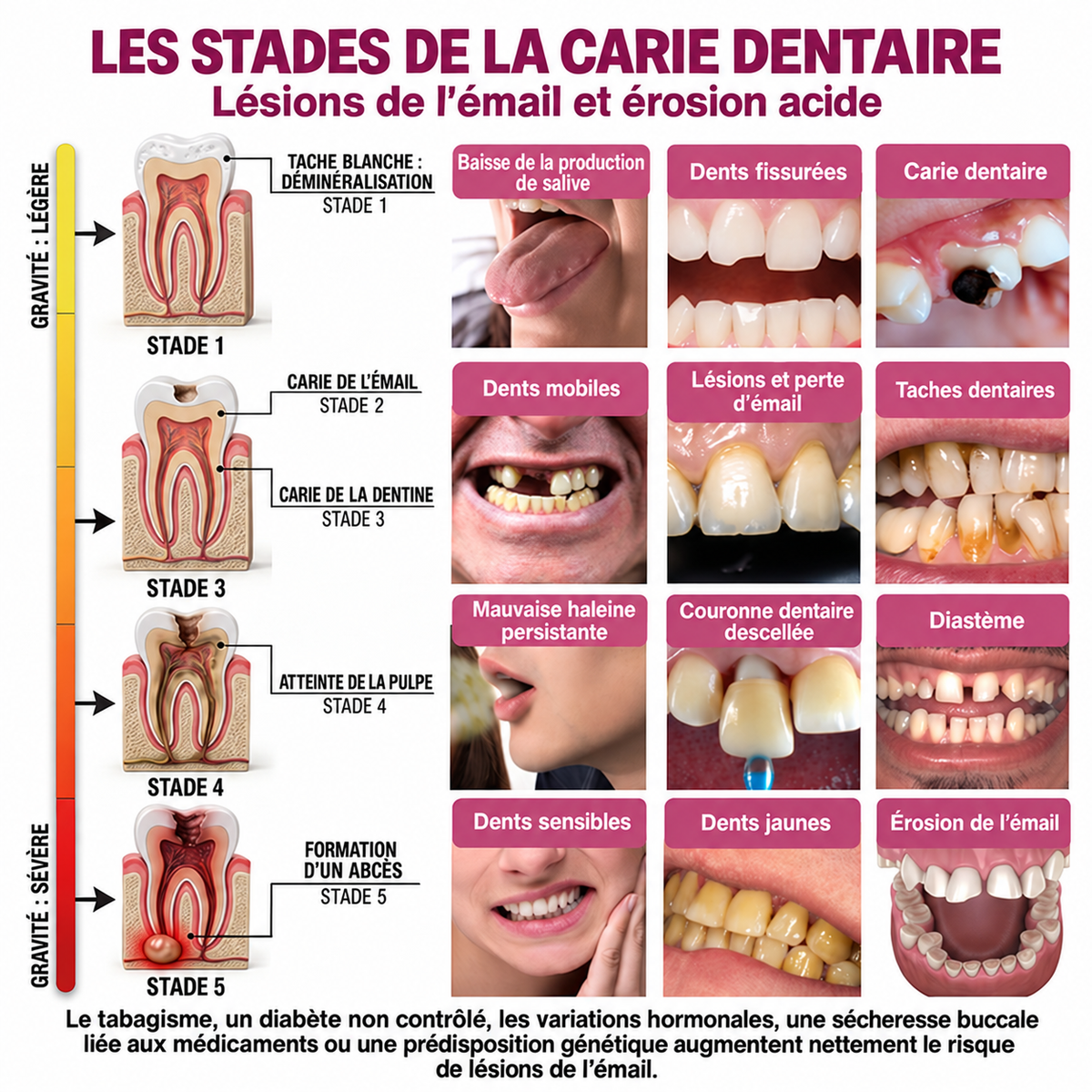 Rolimey® DenPerm | Gel naturel de réparation des caries et de l’émail dentaire