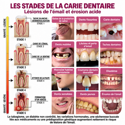 Rolimey® DenPerm | Gel naturel de réparation des caries et de l’émail dentaire