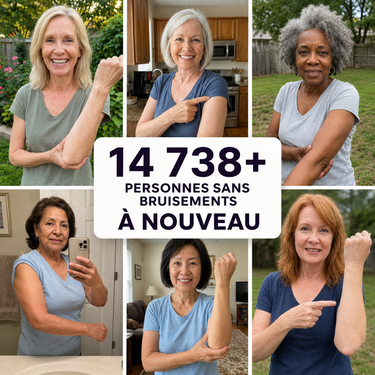 🔥 Celsiora® Crème anti-hématomes – Soin intensif pour les peaux sensibles sujettes aux bleus