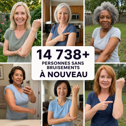 🔥 Celsiora® Crème anti-hématomes – Soin intensif pour les peaux sensibles sujettes aux bleus