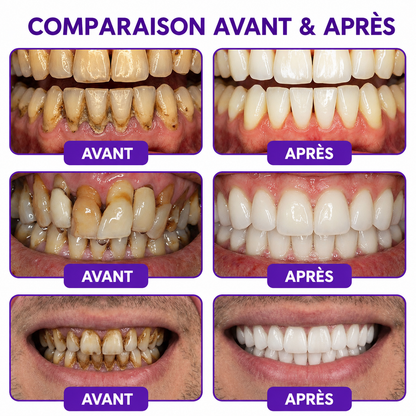 Rolimey® VioCore : Dentifrice au venin d’abeille pour la gingivite et la parodontite