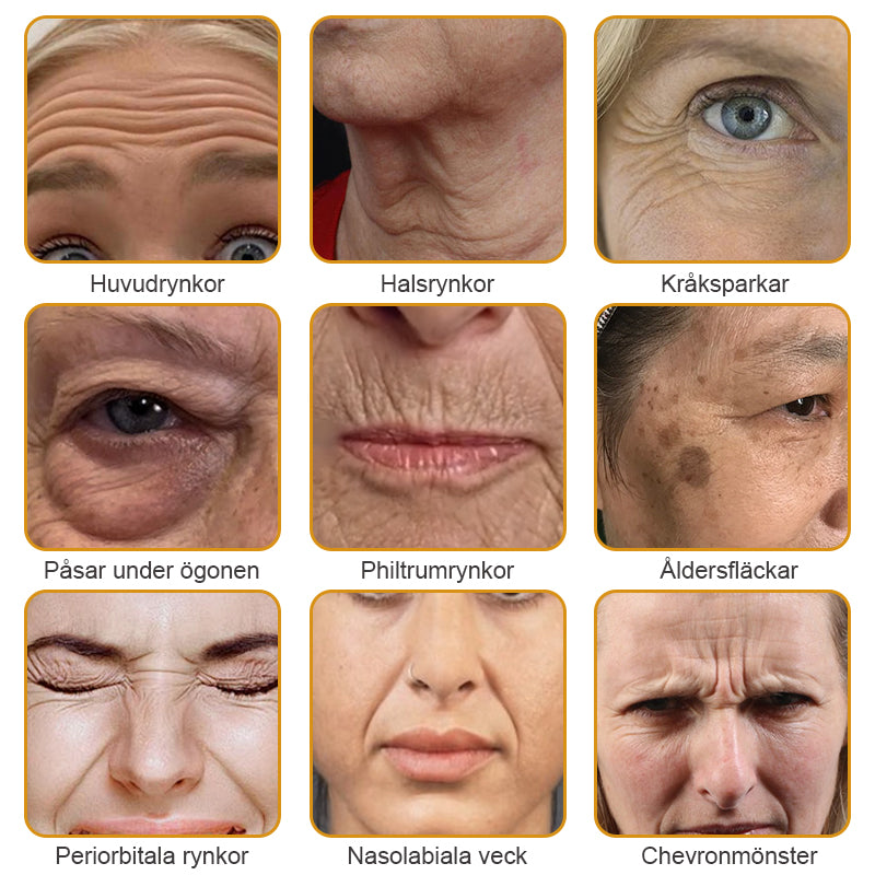 💎✨Tillverkad och skickad från Sverige✅Furzero™ Botox Bee Venom Wrinkle Removal Cream - Sista Dagen-kampanj 70 % RABATT