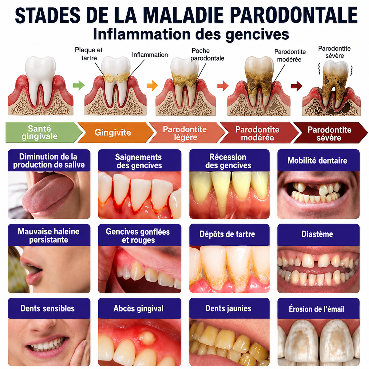 Rolimey® VioCore : Dentifrice au venin d’abeille pour la gingivite et la parodontite