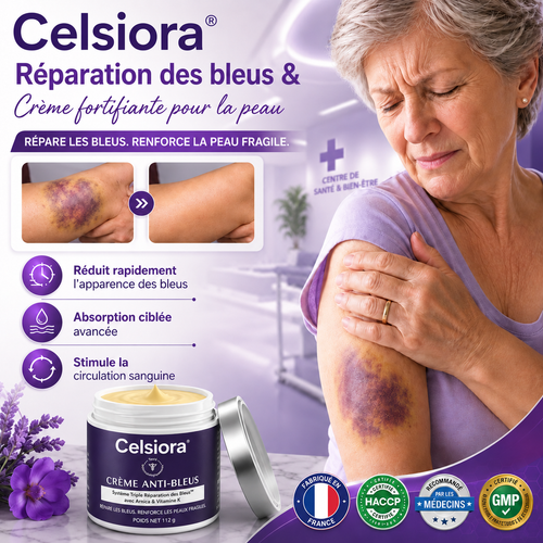 🔥 Celsiora® Crème anti-hématomes – Soin intensif pour les peaux sensibles sujettes aux bleus