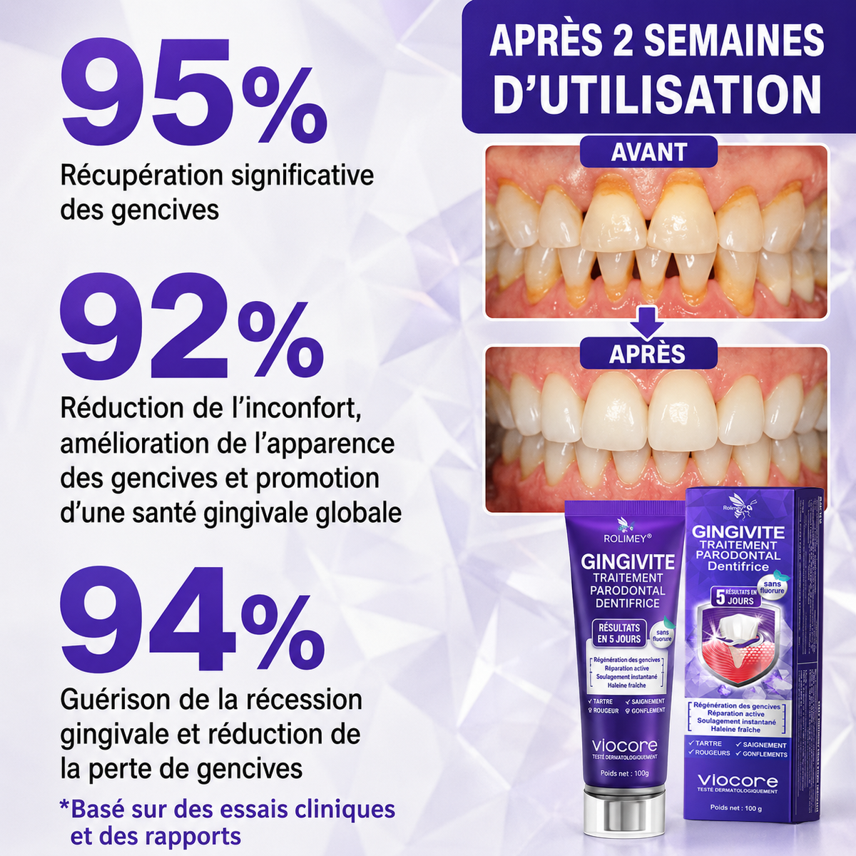 Rolimey® VioCore : Dentifrice au venin d’abeille pour la gingivite et la parodontite