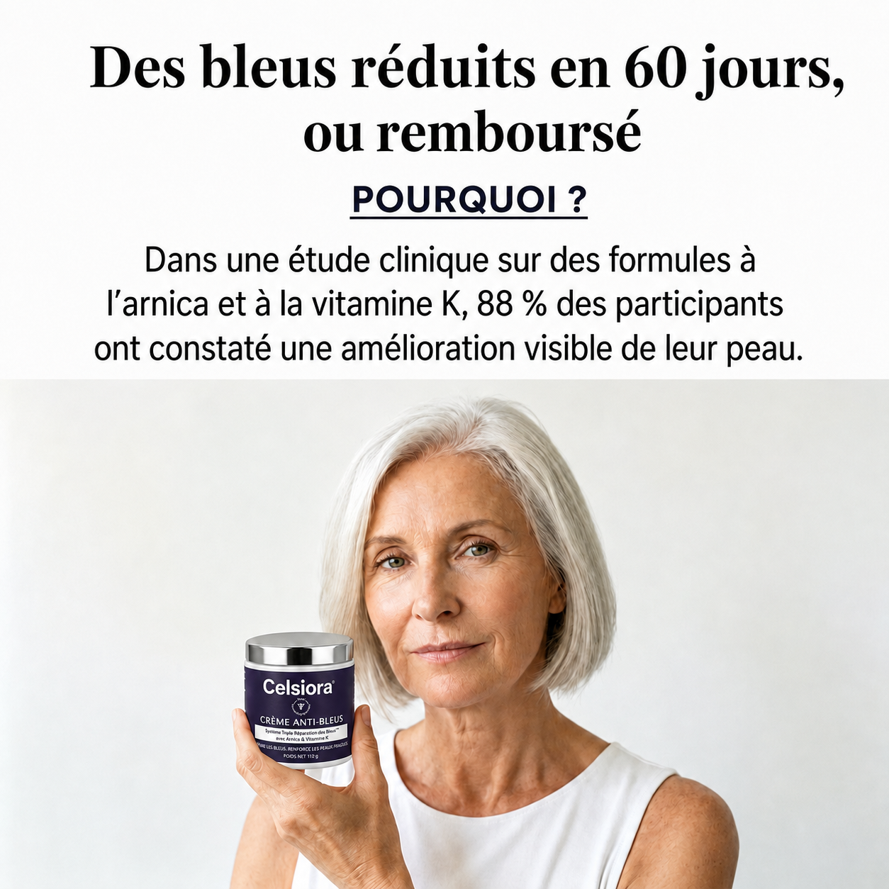 🔥 Celsiora® Crème anti-hématomes – Soin intensif pour les peaux sensibles sujettes aux bleus
