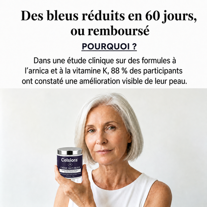 🔥 Celsiora® Crème anti-hématomes – Soin intensif pour les peaux sensibles sujettes aux bleus